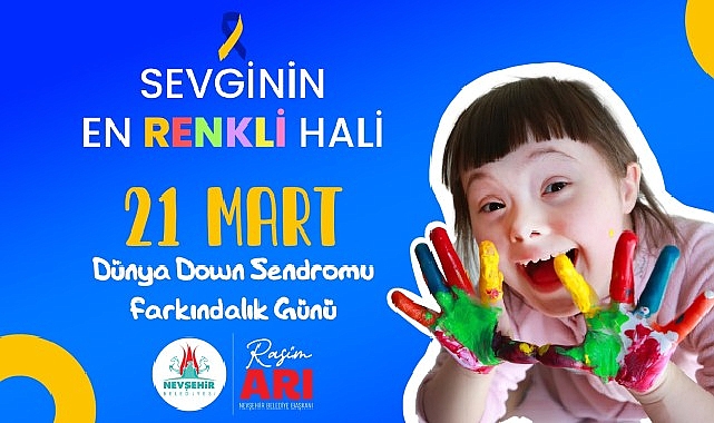 21 Mart Down Sendromu Farkındalık Günü- Haber Seansı